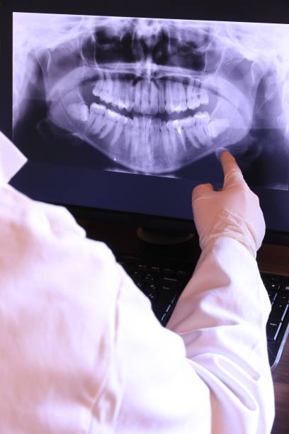 Best Knocked-Out Tooth (Avulsed Tooth) Treatment in Ladonia, AL